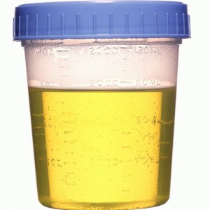 Medical Urine